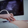 How to Get an X-Ray or Ultrasound in Bay County, Florida